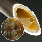 Biofilm bakterie