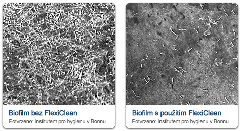 Biofilm ve sprchové hadici