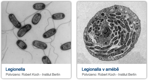 Legionella